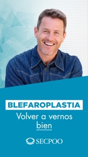 blefaroplastia-stories-hombre