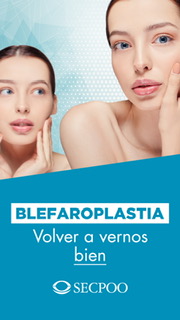 blefaroplastia-stories